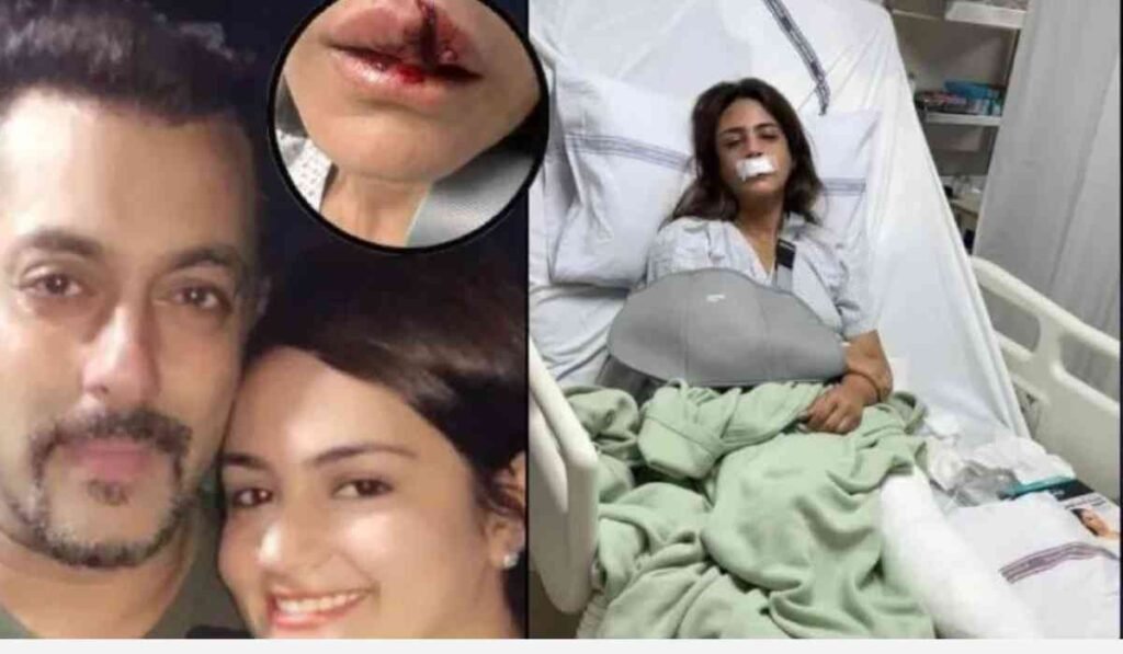 Shweta Rohira Terrible Accident: सलमान खान की मुंहबोली बहन श्वेता रोहिरा का हुआ भयंकर एक्सीडेंट, फैंस हुए चिंतित।