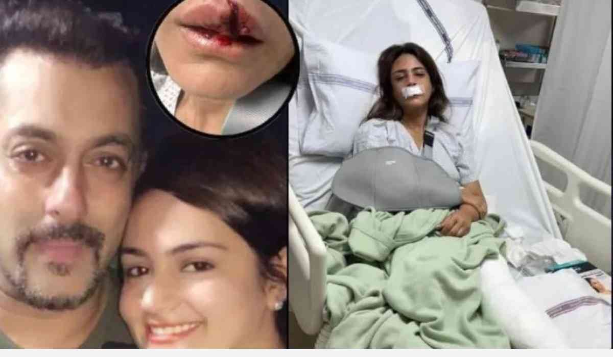 Shweta Rohira Terrible Accident: सलमान खान की मुंहबोली बहन श्वेता रोहिरा का हुआ भयंकर एक्सीडेंट, फैंस हुए चिंतित।